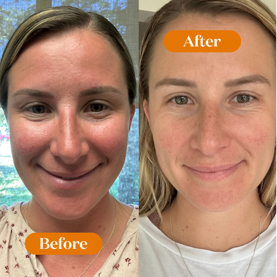 Renewing Night Elixir: Scented